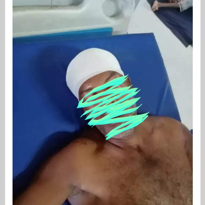 ঈদগাঁওতে নির্যাতনের শিকার মনজুর আর বেঁচে নেই