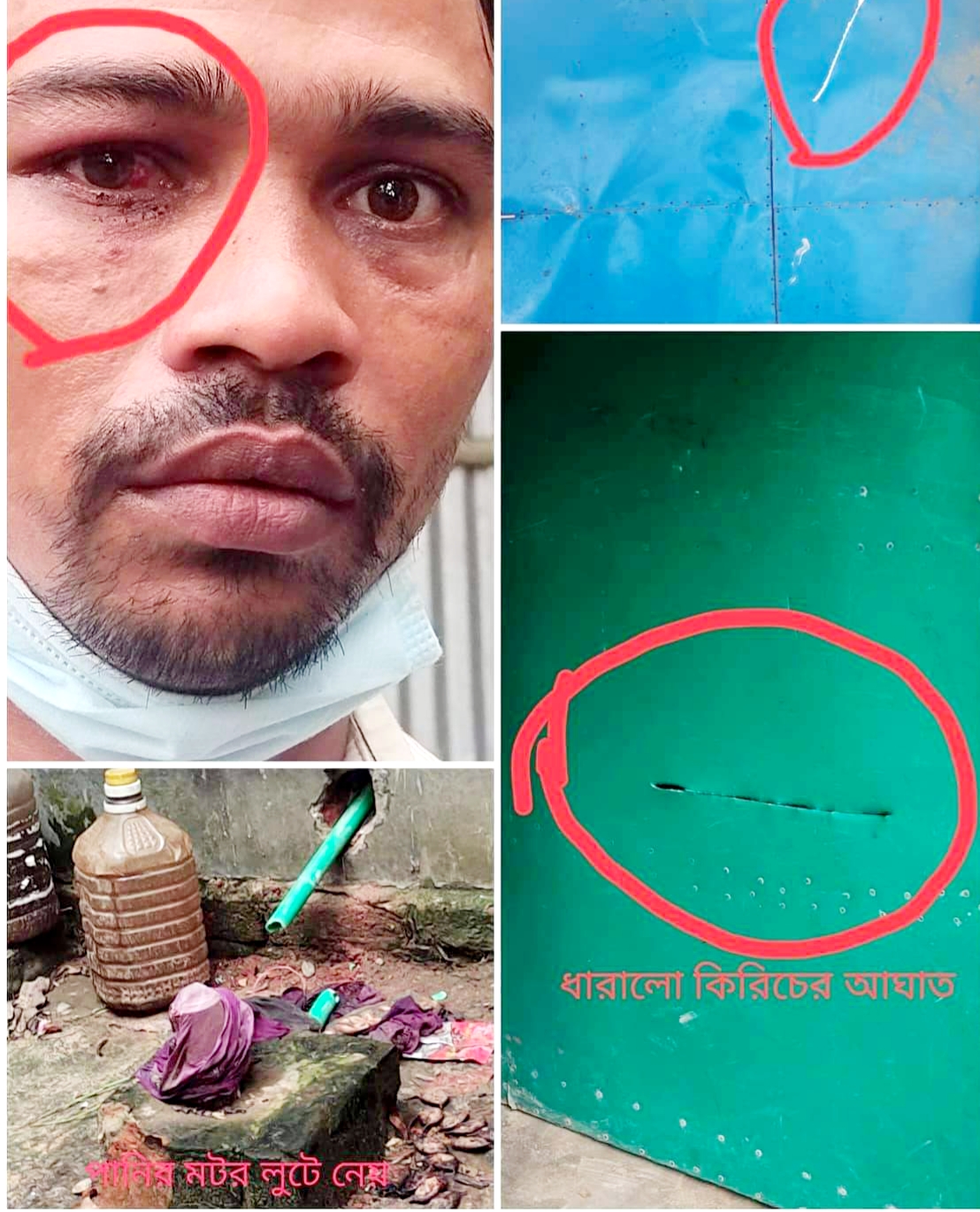 সদরের খুরুশকুলে টমটম চালককে হত্যার চেষ্টা, অন্তঃসত্ত্বা মহিলাসহ আহত ২